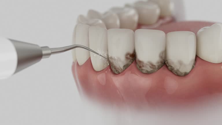 Reliable Dental contractor in Lennox, CA by Smile Center Dentistry